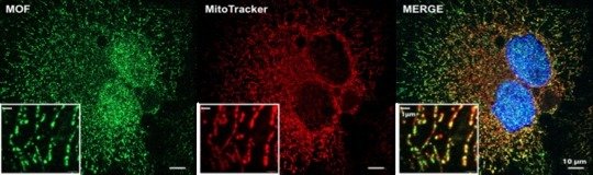 <p><strong>Figure 2</strong> Fluorescence microscopy images of human (HeLa) cells expressing green fluorescent proteins tagged MOF (green) co-stained with red fluorescent dye for mitochondria (red) and DAPI for nucleus (blue).</p>
