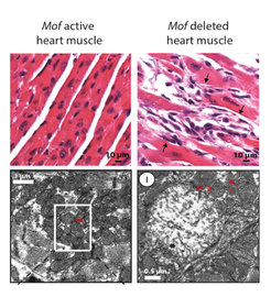 <p><strong>Figure 3</strong> Electron microscopy images of cardiac muscle (cardiomyocytes) tissue from normal and <em>Mof </em>deleted mice are shown. The upper panels show the tissue structure. The lower panels give a more detailed view of the mitochondria. Red arrow 1 indicate a normal mitochondria. Red arrow 2 indicate a degenerated and dysfunctional mitochondria.</p>