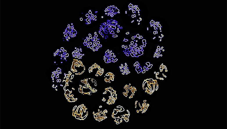 <p><strong>“Yin and Yang” of T cell fate. </strong>The shape of mitochondria controls T cell metabolism and immune reaction.</p>
