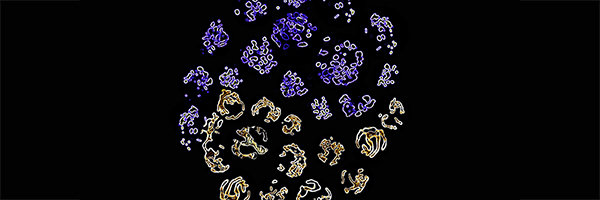 Post-transcriptional regulation of T cell function by metabolic enzymes Post-transcriptional regulation of T cell function by metabolic enzymes