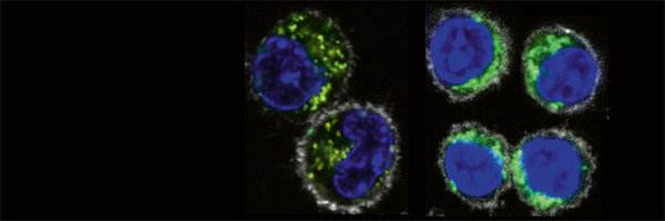 Stoffwechsel der T-Gedächtniszellen