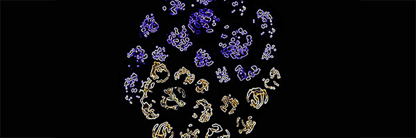Posttranskriptionelle Regulation von T-Zell-Funktionen durch Stoffwechselenzyme Posttranskriptionelle Regulation von T-Zell-Funktionen durch Stoffwechselenzyme