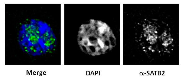 Subnukleäre Lokalisierung von Satb2, einem Regulator der übergeordneten Chromatin-Struktur im Interchromatin-Bereich.