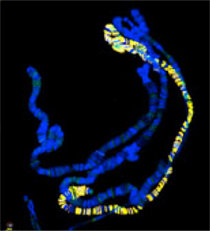Dosis compensation is the main research interest in Asifa Akhtar's laboratory. Here, the male X-chromosome in fruitflies is shown in yellow.