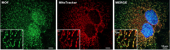Figure 2 Fluorescence microscopy images of human (HeLa) cells expressing green fluorescent proteins tagged MOF (green) co-stained with red fluorescent dye for mitochondria (red) and DAPI for nucleus (blue).
