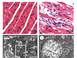 Figure 3 Electron microscopy images of cardiac muscle (cardiomyocytes) tissue from normal and Mof deleted mice are shown. The upper panels show the tissue structure. The lower panels give a more detailed view of the mitochondria. Red arrow 1 indicate a normal mitochondria. Red arrow 2 indicate a degenerated and dysfunctional mitochondria.
