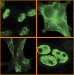 RNA-binding proteins can regulate gene expression in the nucleus and cytoplasm of human cells. Here, three RNA-binding proteins KHDRBS1 (top, left), KHDRBS2 (bottom, left) and KHDRBS3 (bottom, right) are shown to localize to the nucleus, the cytoplasm and the nucleus of human cells, respectively. A point mutation in KHDRBS1 completely changes its cellular localization and turns it into a cytoplasmic protein (top, right). Using uvCLAP, the RNA targets of all of these proteins (and more) have been studied simultaneously to find out how changes in the localization of RNA-binding proteins affect their target RNAs.