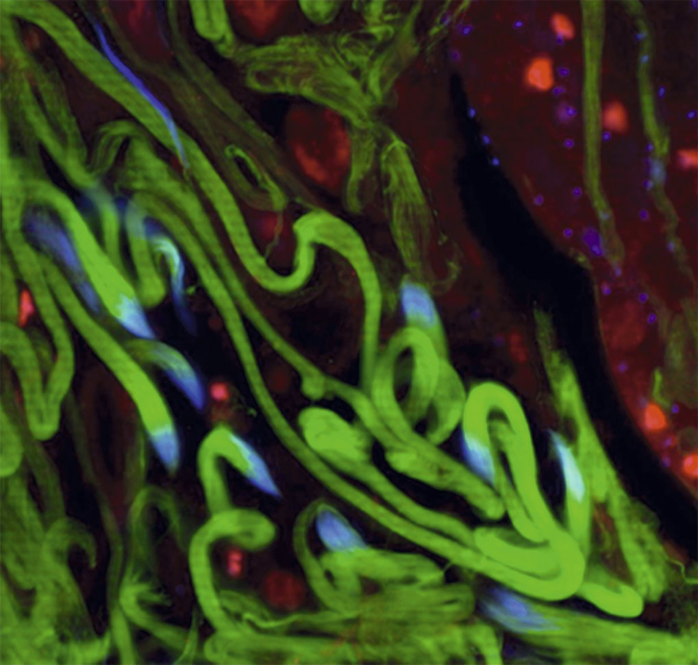Figure 1 The fruit fly, Drosophila melanogaster, has some of the longest sperm cells of any species. Here one can see bundles of blue headed, green tailed sperm during late sperm development. These single cells are able to carry epigenetic memories of parental experi- ence or stress and re-shape complex phenotypes of the offspring.