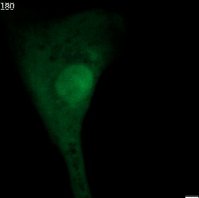 Fig. 1 Immunofluorescence microscopy showing the formation of nuclear blebs and micronuclei protruding from the main nucleus.