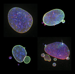 Fig. 2 Various nuclear shape abnormalities such as micronuclei and nuclear blebs both close to the main nucleus. Nucelar shape abnormalities can lead to a severe impact on genomic DNA integrity.