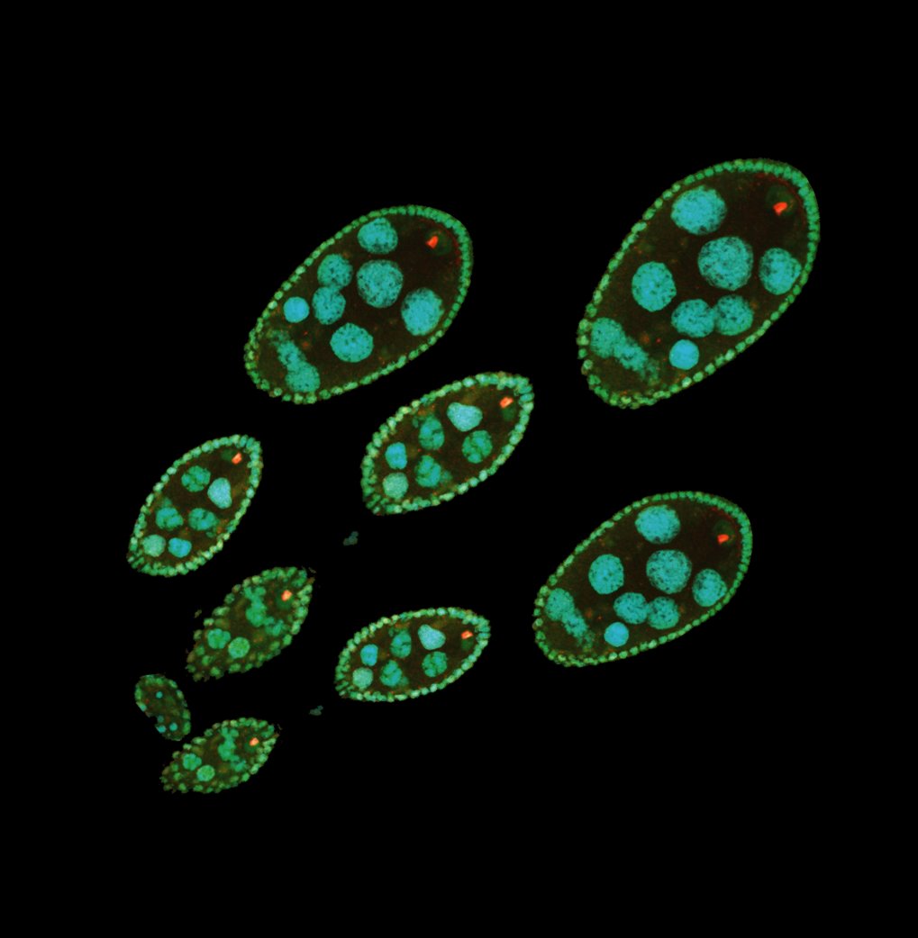 Fig. 2 Immunofluorescent staining of Drosophila ovaries containing oocytes. The red stained H4K16ac histone modification is clearly visible in the individual oocytes. The enzyme MOF (green) is responsible for the deposition of the H4K16ac modification. The DNA (cyan), the carrier of the genetic information, has also been stained to become visible.