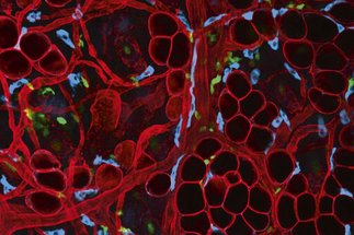Novel tools for understanding immune cell movement in tissues