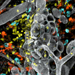 Several immune cell subsets are present in inflamed tissues. Neutrophils (yellow) were recruited from the bloodstream and cooperate with tissue-resident mast cells (blue) and dendritic cells (orange) during an innate immune response, which here occurs around an accumulation of fat cells (white in middle).