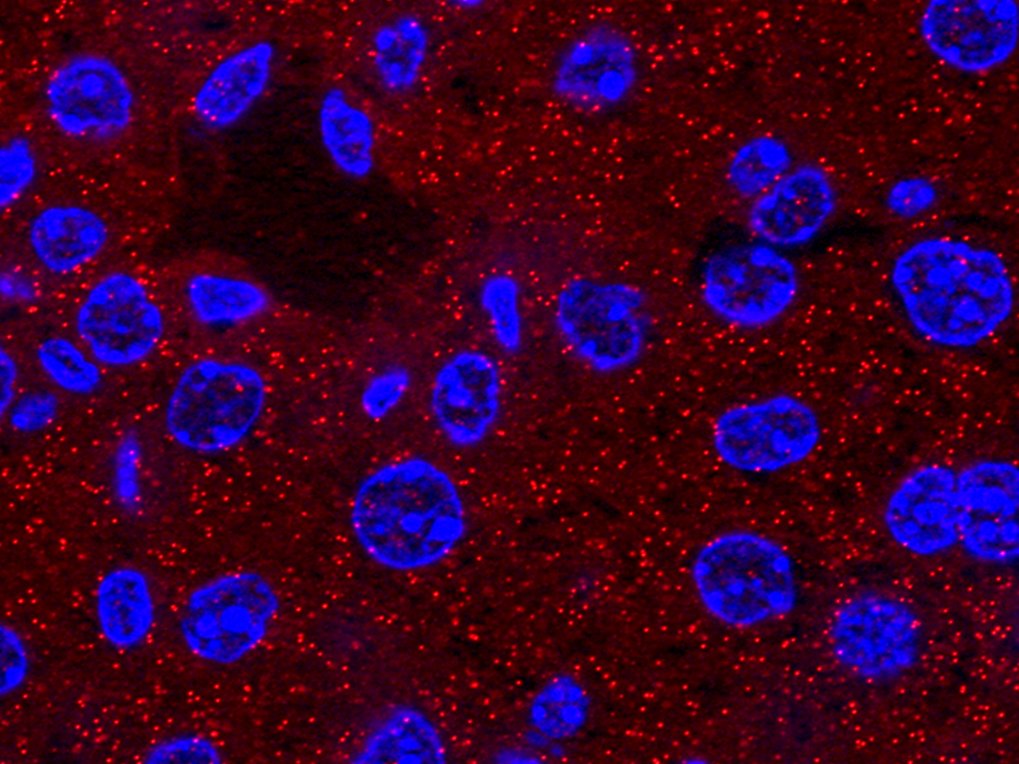 The role of biological gene expression noise during cellular differentiation