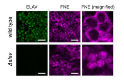 Activated FNE enters the nucleus only in the absence of ELAV. Microscopy image of neuronal cells in Drosophila embryos. ELAV and FNE proteins are made visible by immunohistochemistry. Scale bars: 10µm