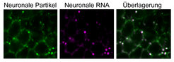 Mikroskopische Aufnahmen von Nervenzellen eines Fliegengehirns. Neuronale Körperchen wurden durch Antikörperfärbungen eines RNA-bindenden Proteins sichtbar gemacht, und eine nicht-kodierende RNA durch in situ Hybridisierung.