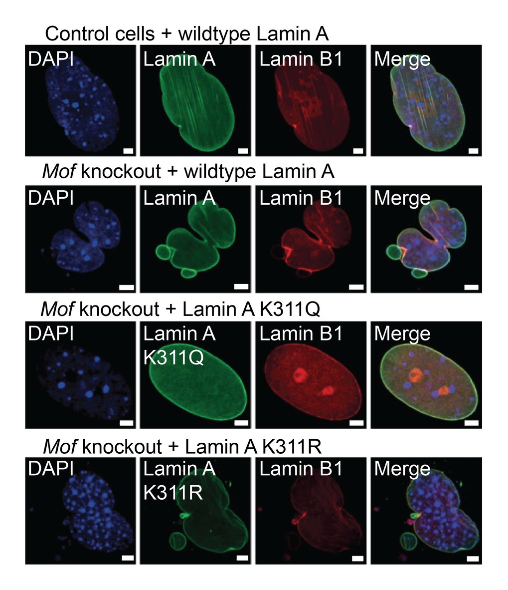 Deletion of Mof in mouse embryonic fibroblasts results in emergence of nuclear abnormalities including micronuclei and nuclear blebbing. MOF is a lysine acetyltransferase which acetylates Lamin A at residue K311. Expression of Lamin A carrying an amino acid substitution from K to Q (mimicking a constitutively hyperacetylated state) is capable of restoring a normal nuclear morphology. On the other hand cells with a K to R mutant (mimicking a constitutively hypoacetylated state) still exhibit nuclear abnormalities following Mof knockout.