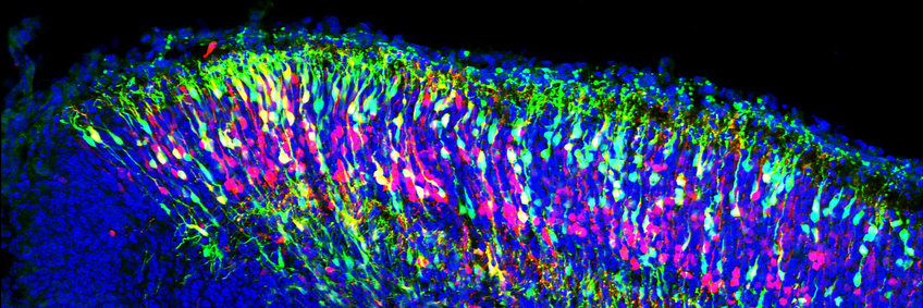 Fluoreszenzbild der embryonalen Hirnentwicklung in der Maus.