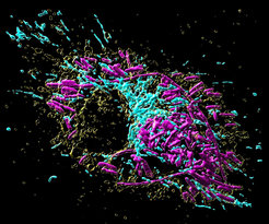 Makrophage, die von Salmonellen(magenta) befallen ist. Farblich abgesetzt sind die Organellen (Mitochondrien in blau und Lysosomen in magenta) dargestellt.