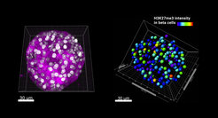 Links: 3D-Rekonstruktion einer aus Mäusen isolierten Bauchspeicheldrüseninsel, die eingefärbt wurde, um die Histonmodifikation H3K27me3 (weiß) und Insulin (magenta) zu markieren. Rechts: Farbliche Markierung der H3K27me3-Intensitätin Beta-Zellen.