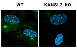 Zytoplasmatische Mikrotubuli in Podozyten, in denen das KANSL2-Protein funktionslos gemacht wurde, repolymerisieren langsamer (rechts). Mikroskopische Aufnahmen von primären Podozyten 5 Minuten nach Entfernung des Depolymerisationsreagenzes. Mikrotubuli sind mit α-Tubulin (grün) markiert. Die Zentrosomen sind mit γ-Tubulin (rot) markiert. Die Zellkerne sind mit DAPI (blau) markiert.